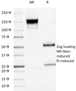 Alkaline Phosphatase/ALPP Antibody (ALPP/516), Novus Biologicals 0.2mg;